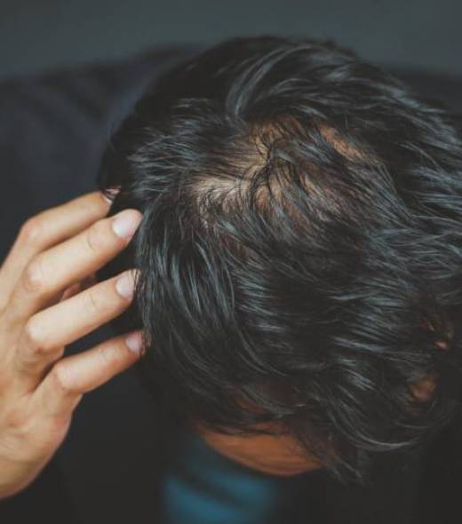 Les cheveux clairsemés chez l'homme : causes et solutions - HRS